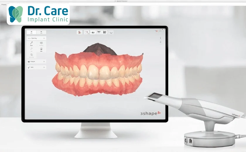Máy scan trong miệng 3Shape TRIOS tại Dr. Care